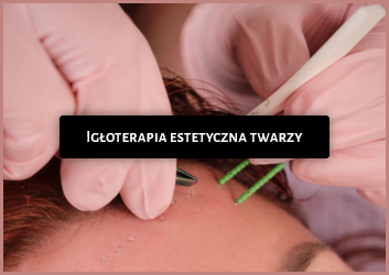 Screenshot 2026-03-24 at 11-24-10 Projekt Blizna - Projekt Blizna