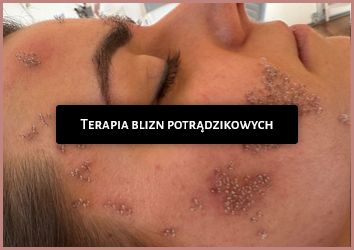 Screenshot 2026-03-24 at 11-24-26 Projekt Blizna - Projekt Blizna